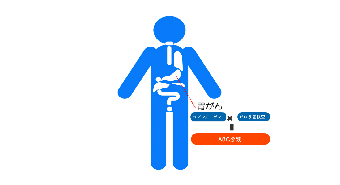 ABC分類の有効範囲