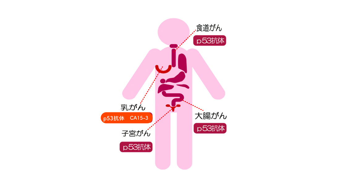 CA15-3検査の有効範囲